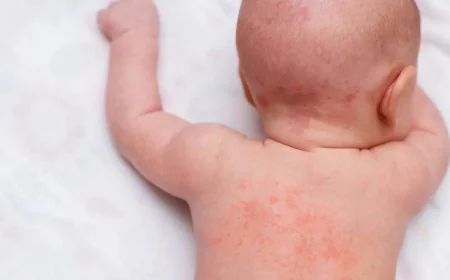 Çocuklarda döküntü alarmı: Uzmanlar viral enfeksiyonlara işaret ediyor